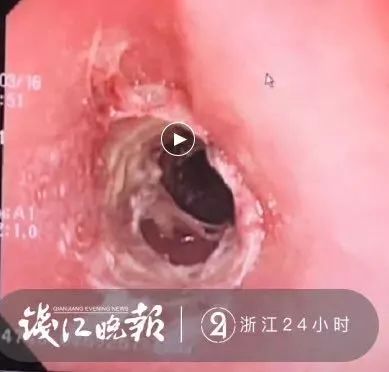 吃药时,怎么喝水才是正确的?