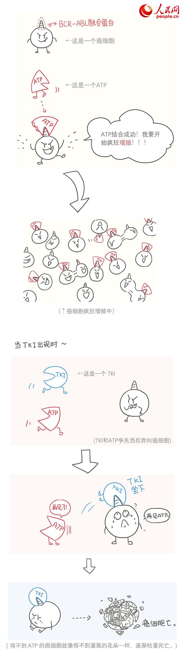 从格列卫开始 谈谈治疗慢性粒细胞白血病的“神药”