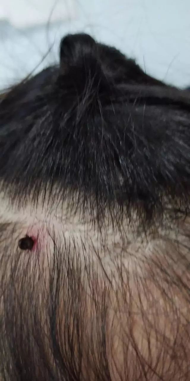 蜱虫是一种什么虫?对人有哪些危害?