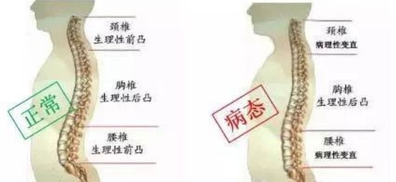教你一招缓解久坐腰痛