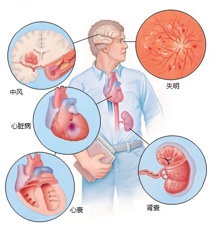 脂肪酸大战