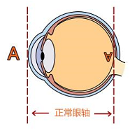 近视的“前世今生” 家有“近视娃”一定要看!