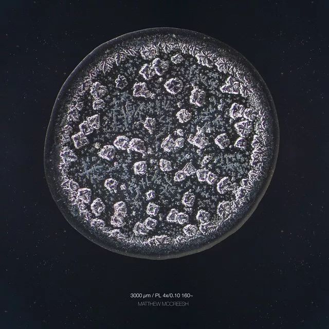 显微镜下的眼泪每滴都不一样?这一滴好像带着刺