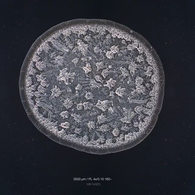 显微镜下的眼泪每滴都不一样?这一滴好像带着刺
