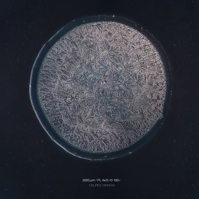 显微镜下的眼泪每滴都不一样?这一滴好像带着刺